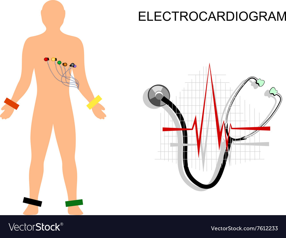 Ekg The Patient With Electrodes On Chest Vector Image