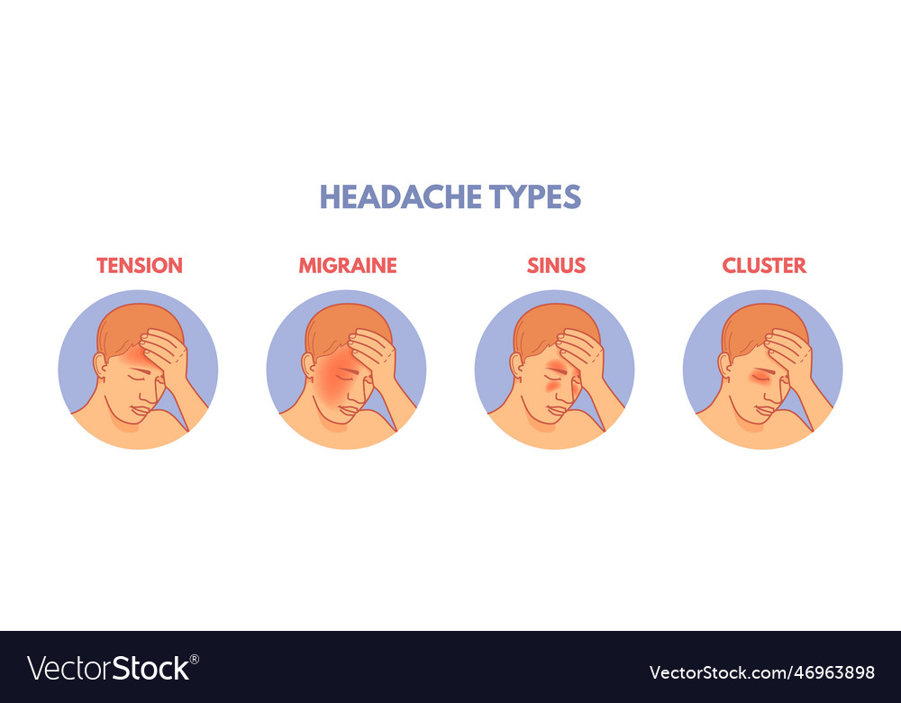 Headache Types Headaches Areas Infographic Vector Image