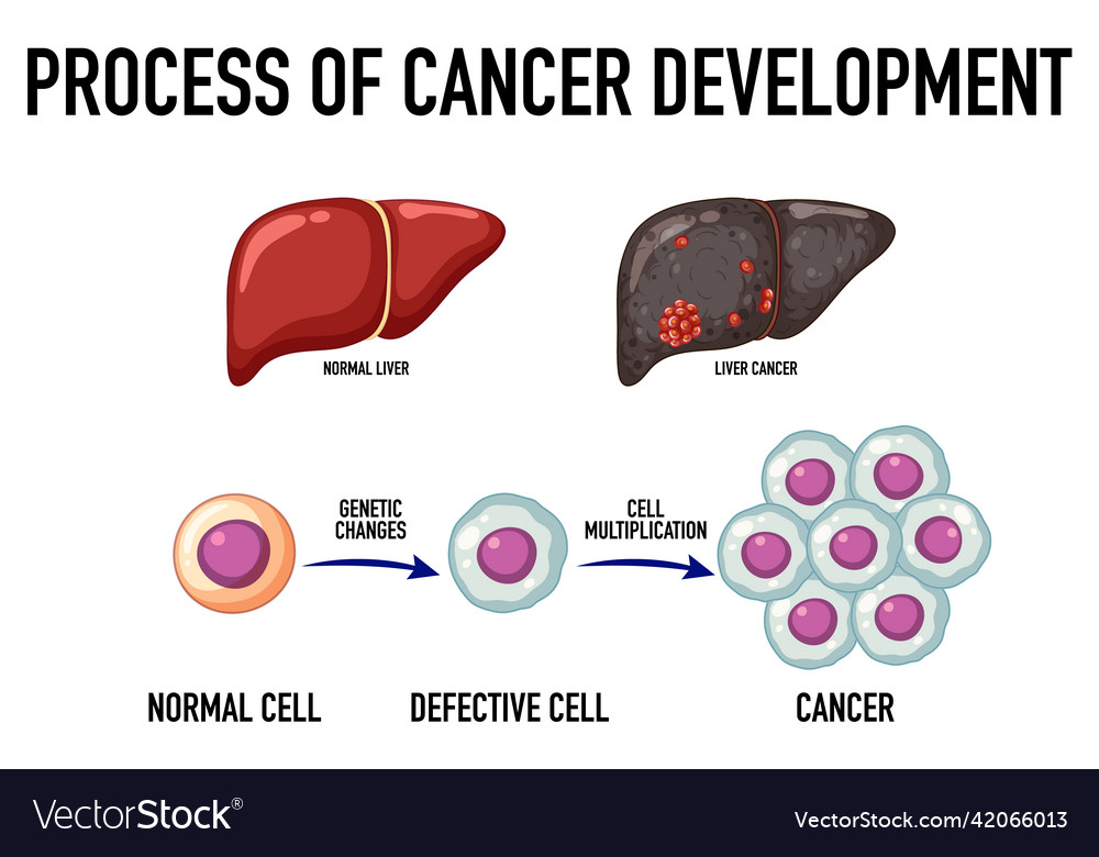 Diagram Showing Cancer Development Process Vector Image