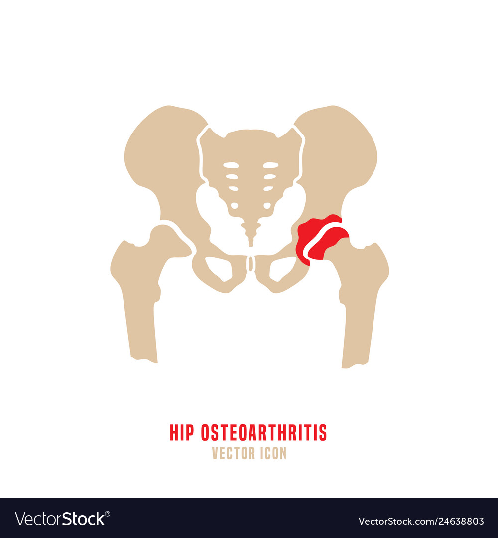 Hip Osteoarthritis Icon Royalty Free Vector Image