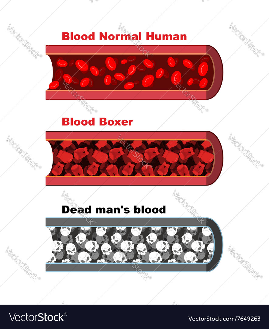 Blood Vessel Of Healthy Person With Normal Vector Image