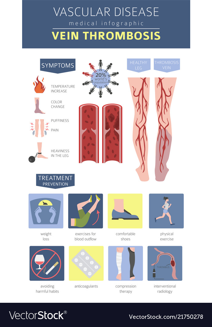 Vascular diseases vein thrombosis symptoms Vector Image