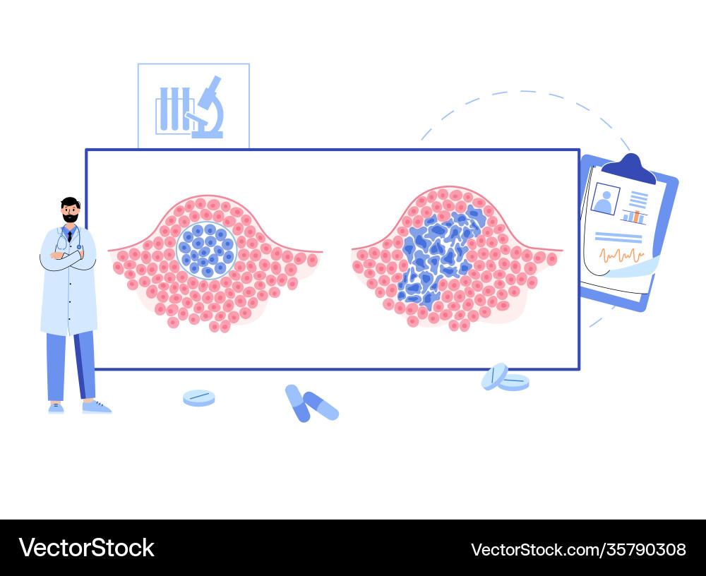 Tumor cells concept Royalty Free Vector Image - VectorStock