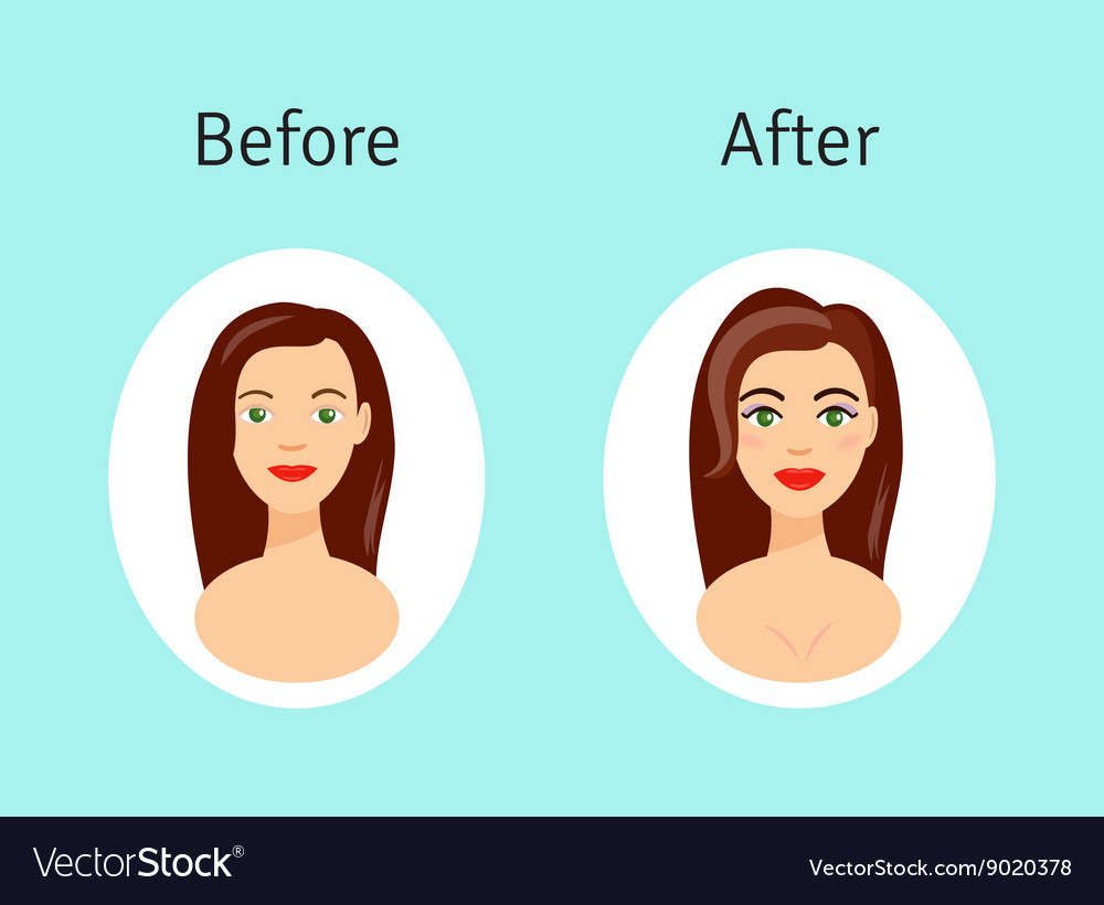 Plastic Surgery Before And After Royalty Free Vector Image 9674