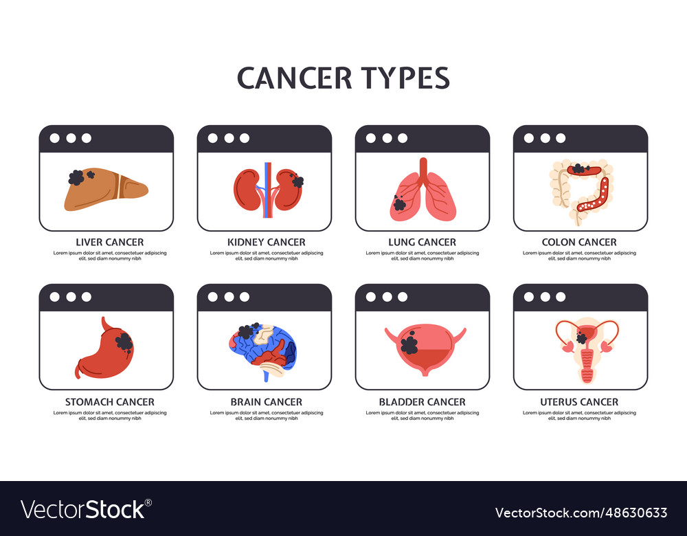 Types of cancer concept Royalty Free Vector Image