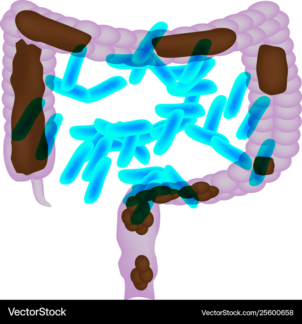 Treatment constipation with probiotics Royalty Free Vector