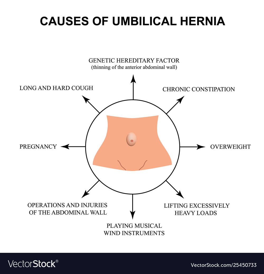 Stomach Hernia Types