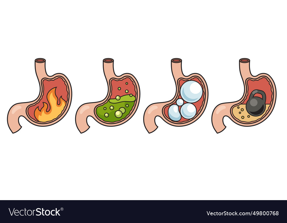 Stomach disease structure diagram medical science Vector Image