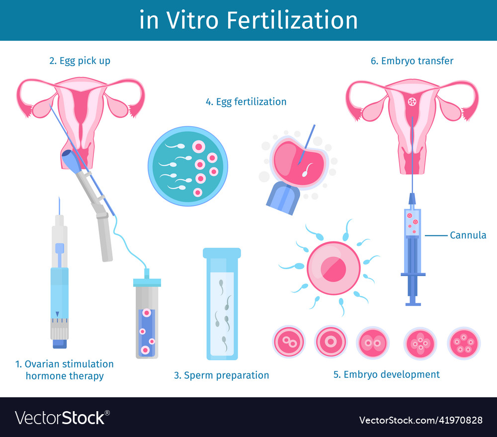 In vitro fertilization process concept Royalty Free Vector