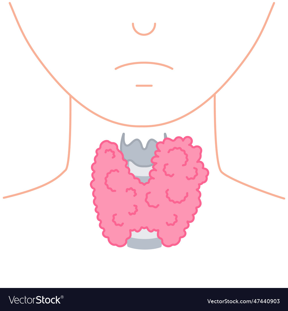 Enlarged Thyroid Gland On Neck Silhouette Diagram Vector Image 3499