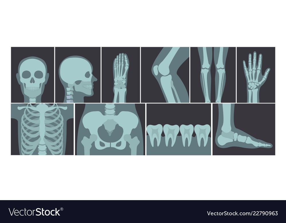 Set of many x-rays shots Royalty Free Vector Image