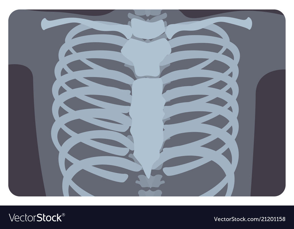 Radiograph x-radiation picture or x-ray image of Vector Image