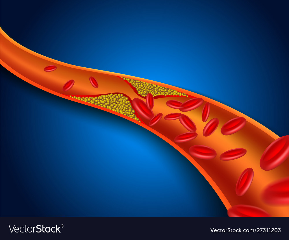 Cholesterol Royalty Free Vector Image Vectorstock Cholesterol Royalty Free Vector Image Vectorstock