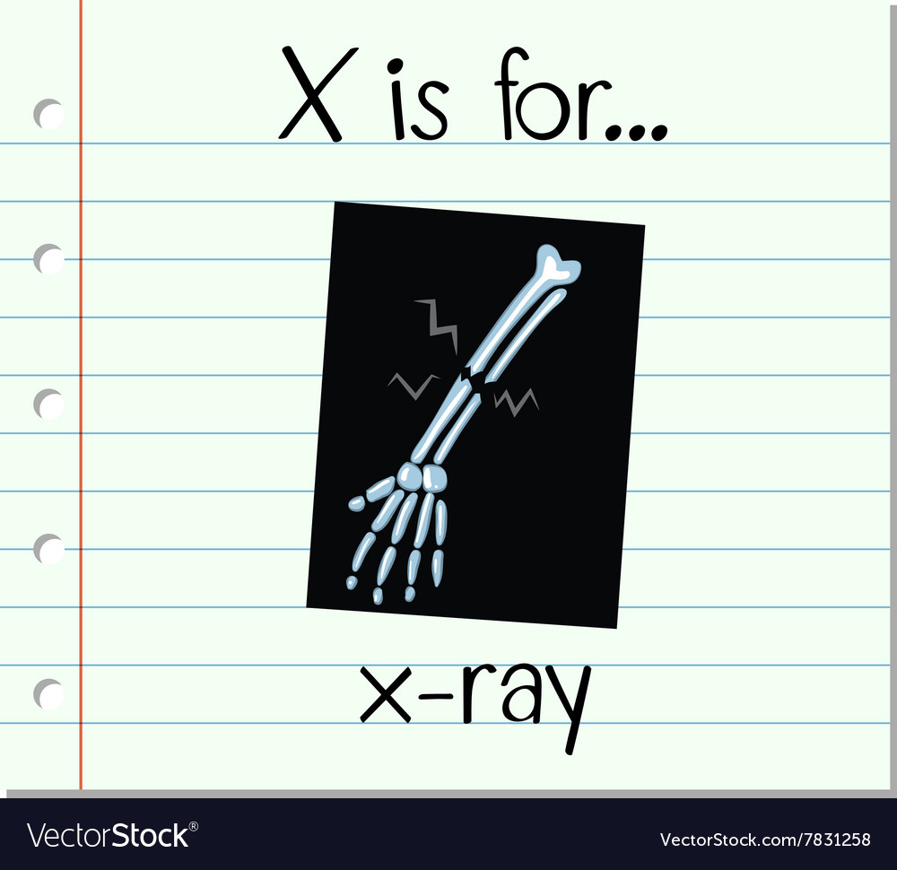 Flashcard letter x is for xray Royalty Free Vector Image