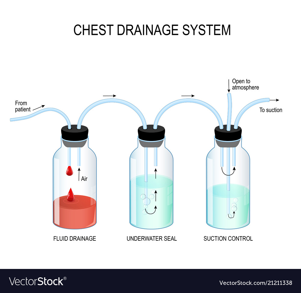 Chest drainage system Royalty Free Vector Image