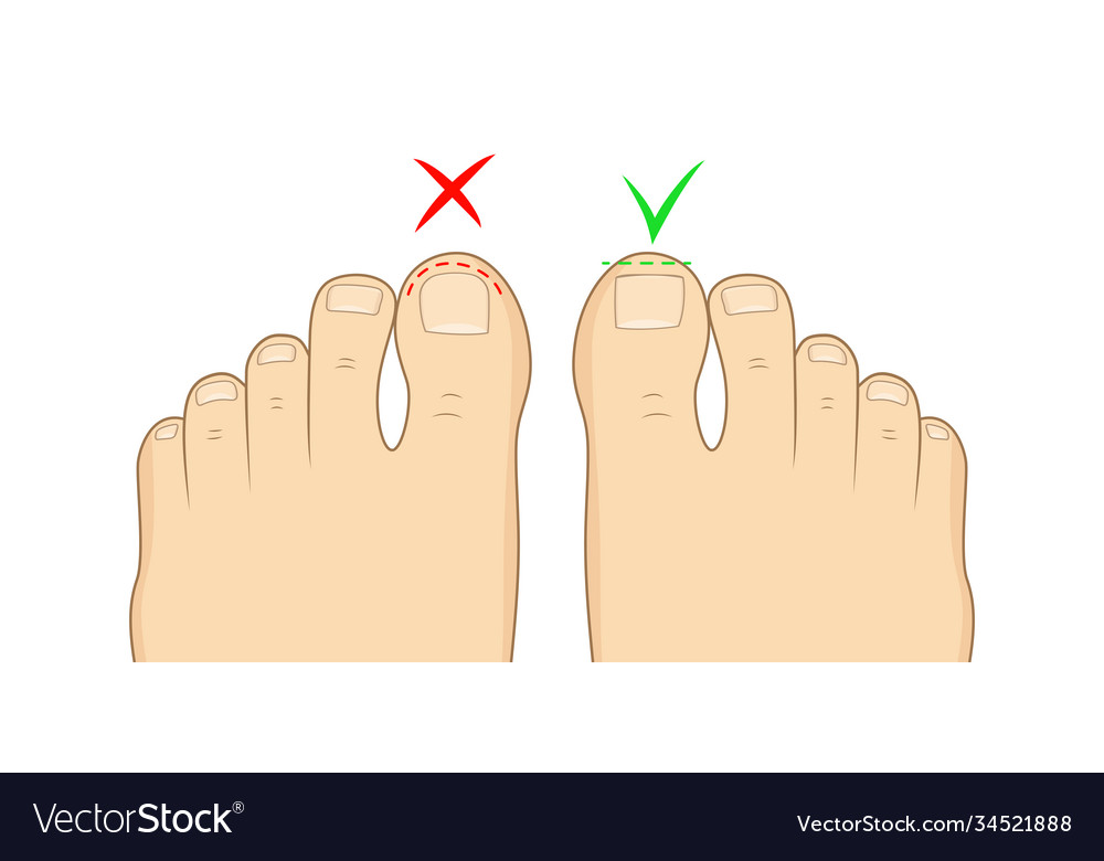 Right To Cut Toenails Royalty Free Vector Image Right To Cut Toenails Royalty Free Vector Image