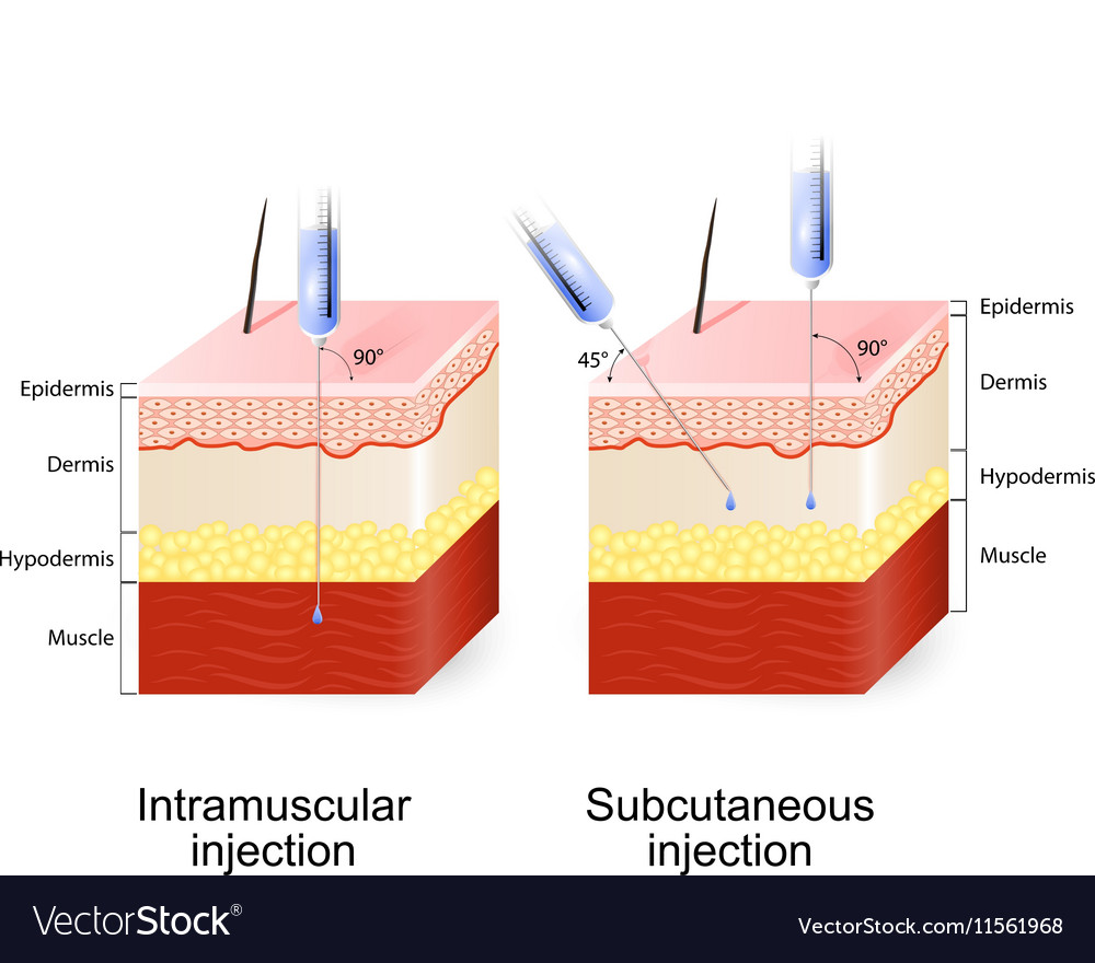 intramuscular injection and subcutaneous injection