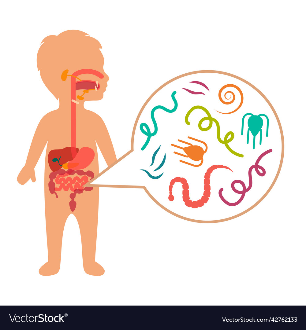 A kid intestinal parasites Royalty Free Vector Image