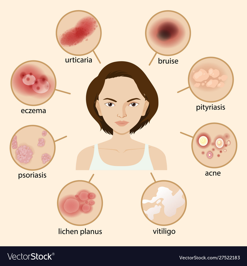 Diagram showing different sickness