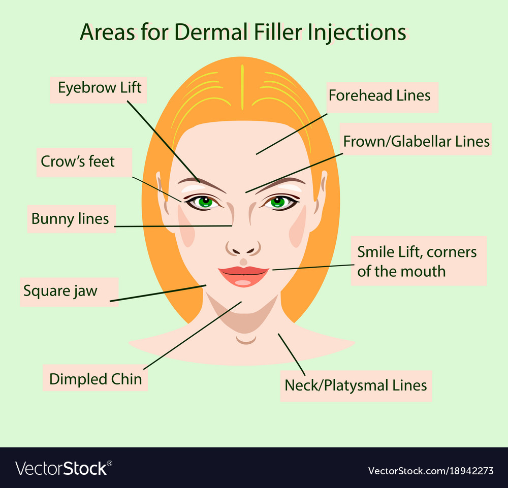 Areas for rejuvenation cosmetological injections Vector Image