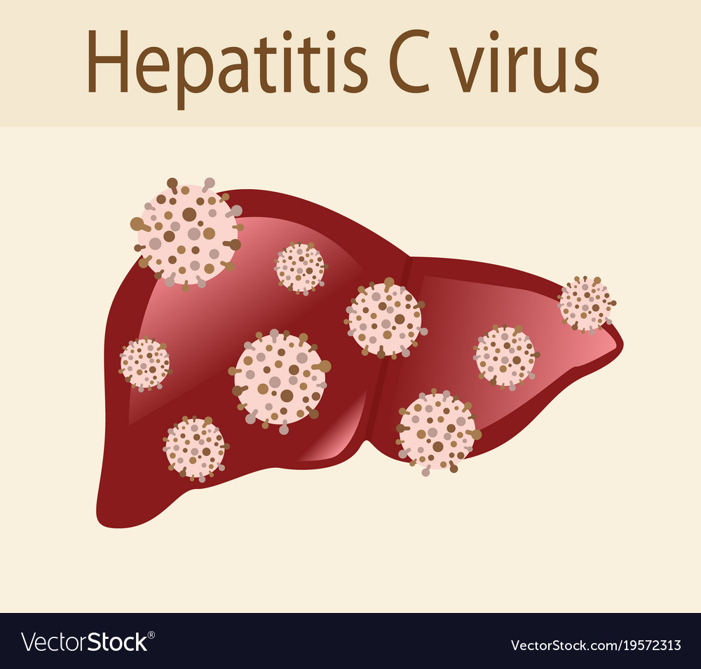 Hepatitis c virus attack liver Royalty Free Vector Image