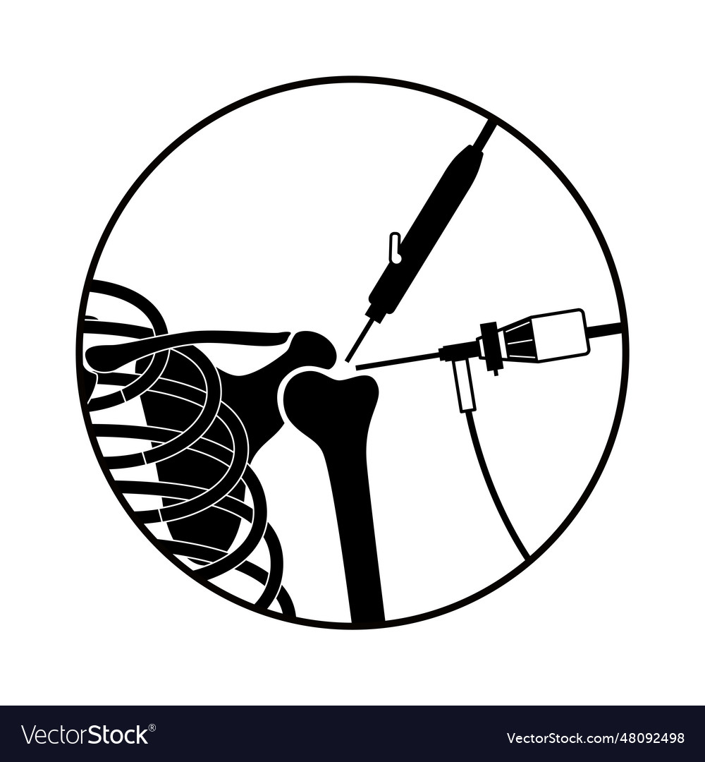 Shoulder arthroscopy poster Royalty Free Vector Image