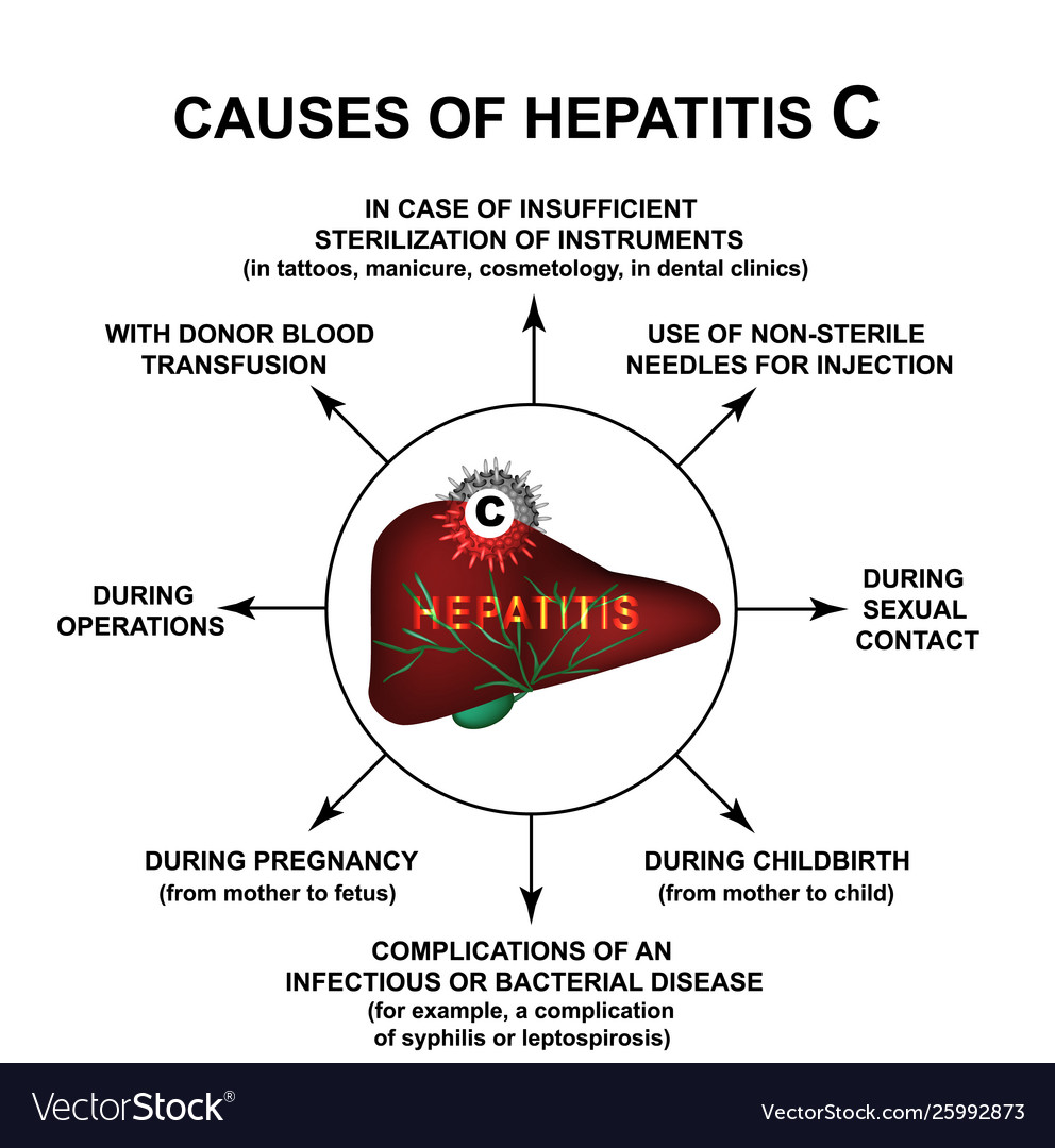 Causes Hepatitis C World Hepatitis Day Royalty Free Vector