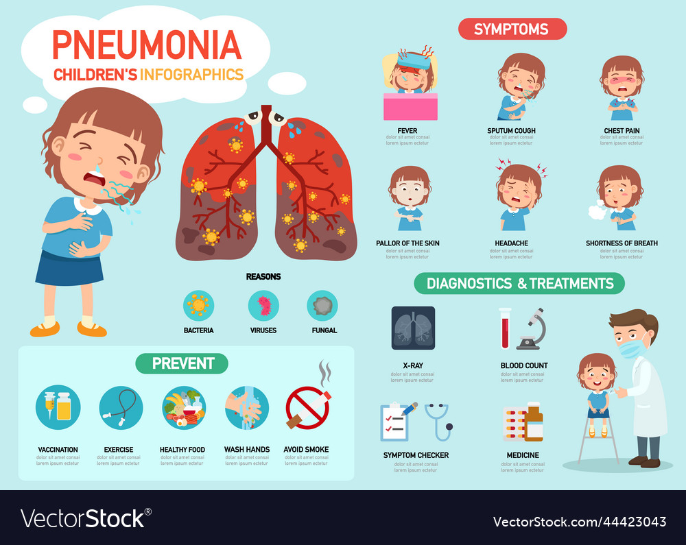 Symptoms Of Pneumonia Infographic Royalty Free Vector Image