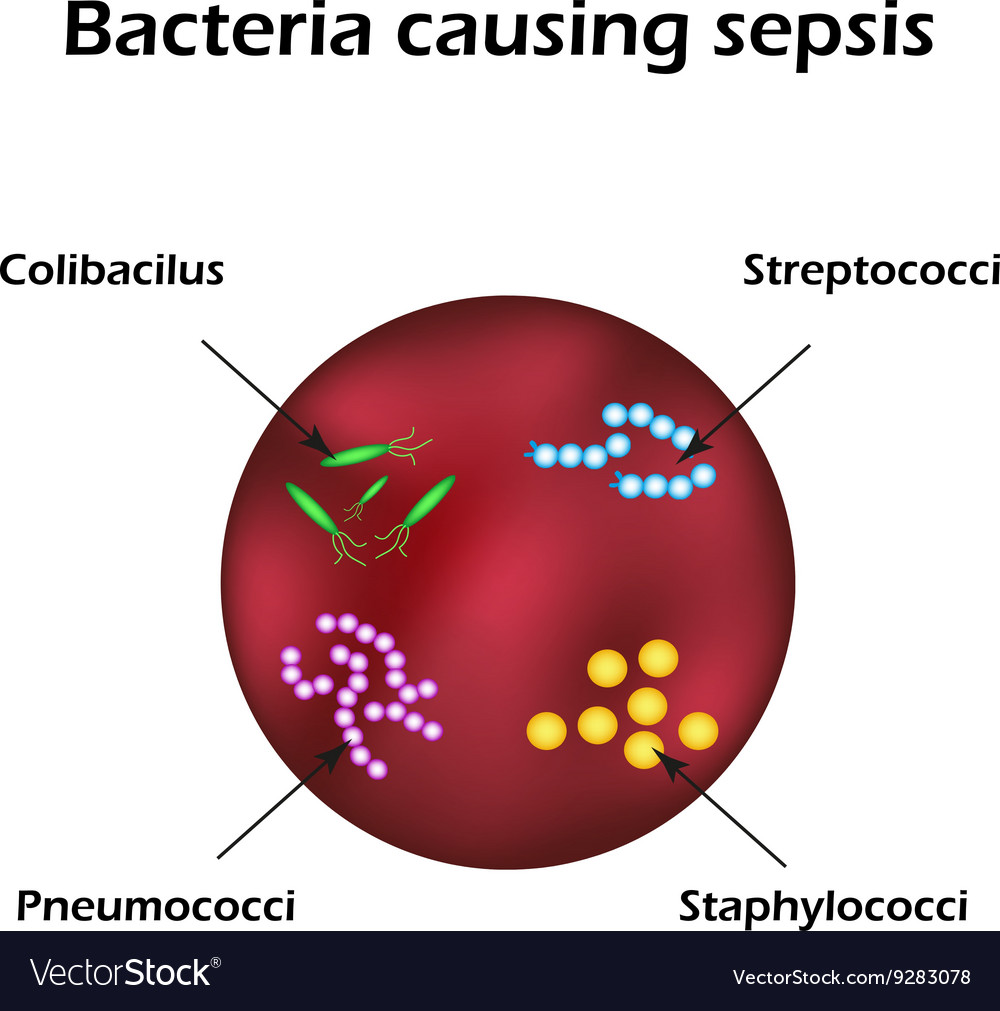 sepsis-blood-poisoning-e-coli-streptococci-vector-image