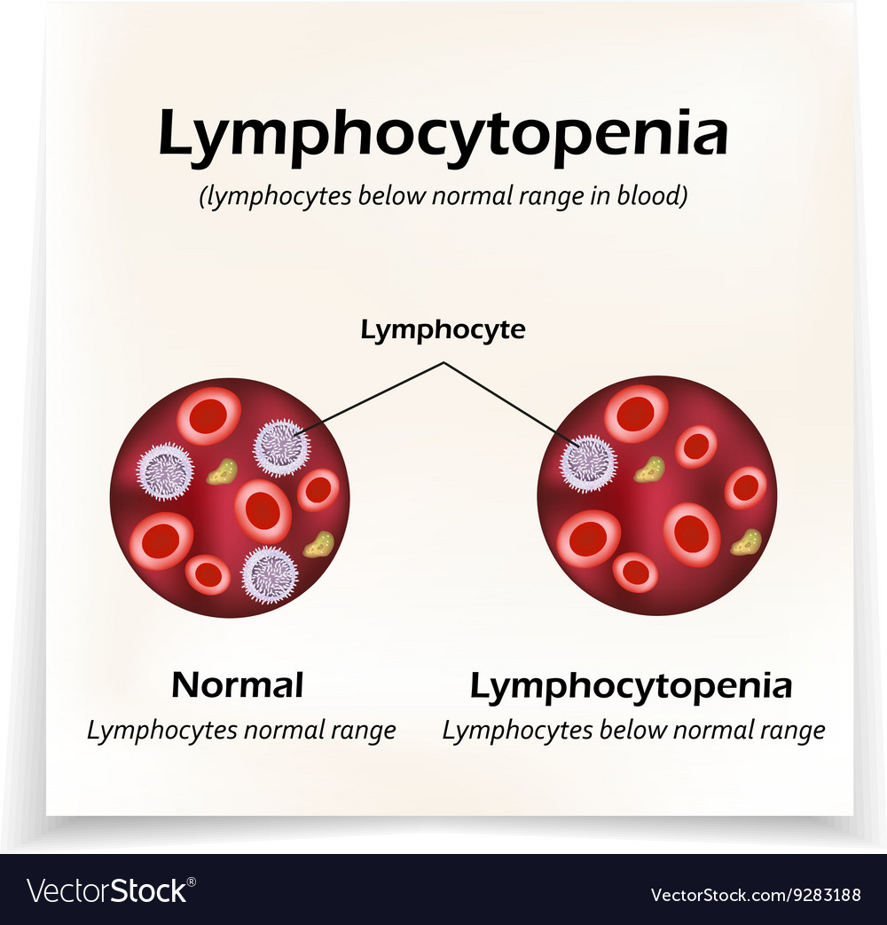 Lymphocytes below normal range in blood Royalty Free Vector