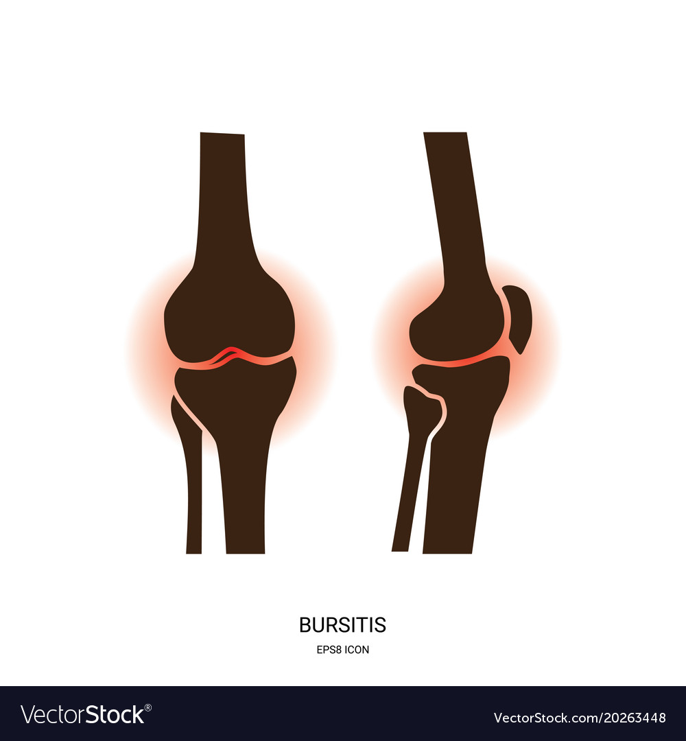 Bursitis And Knee Joint Icon Royalty Free Vector Image