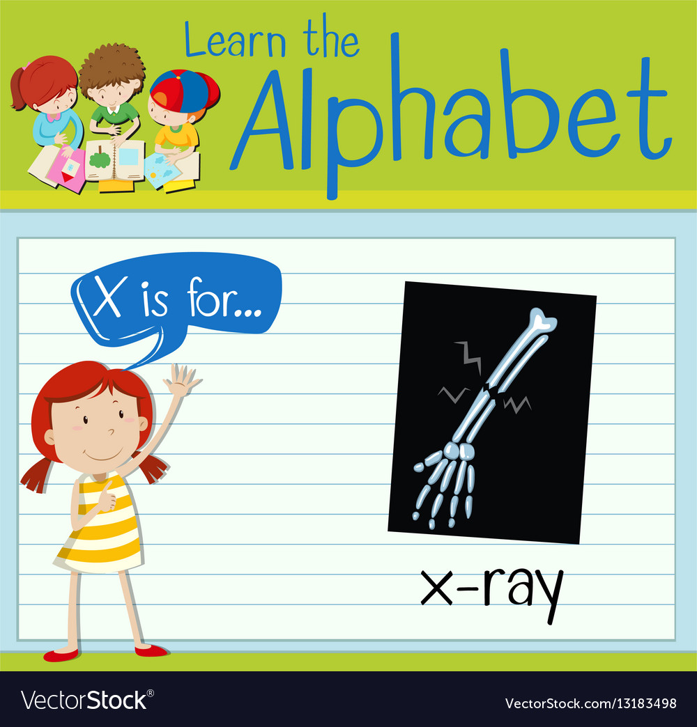 Flashcard letter x is for xray Royalty Free Vector Image