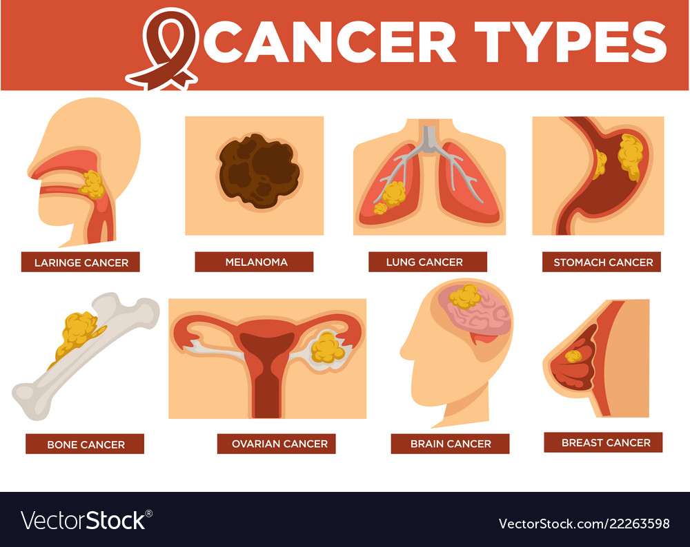 essay on types of cancers