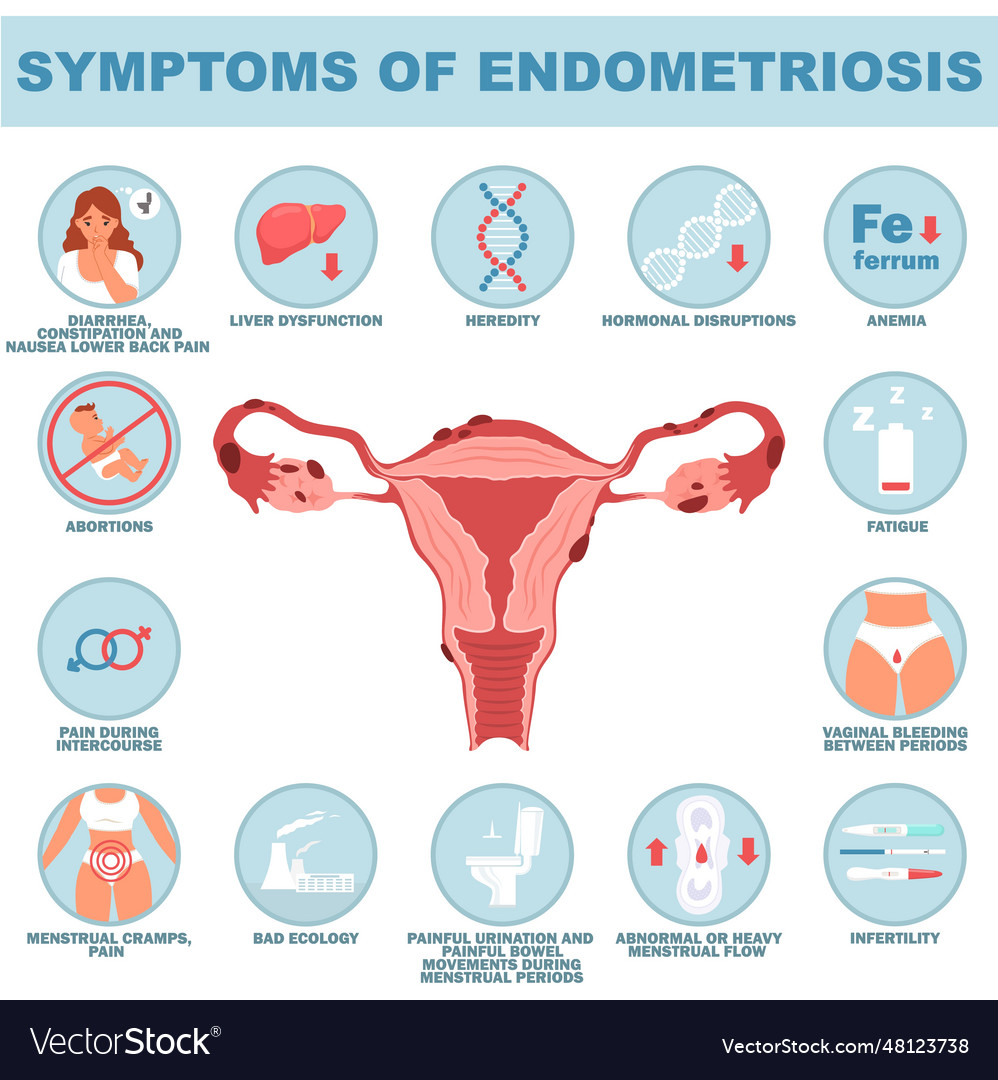 Symptom of endometriosis reproductive disease Vector Image