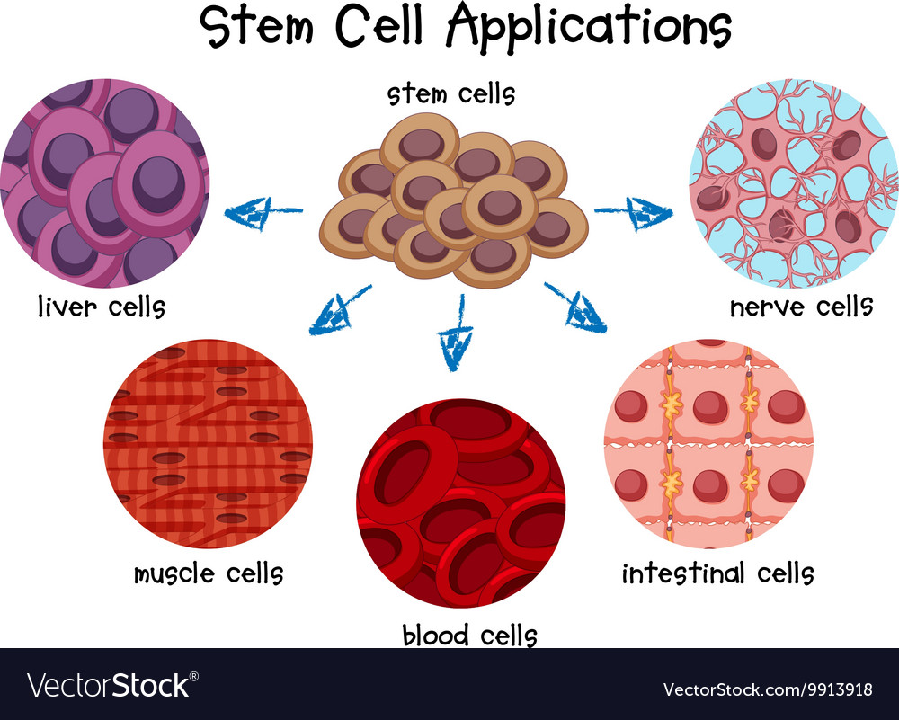 Application cells. Stem Cell Therapy Microbiome. Cancer Cell vector. Стволовые клетки в лечении диабета