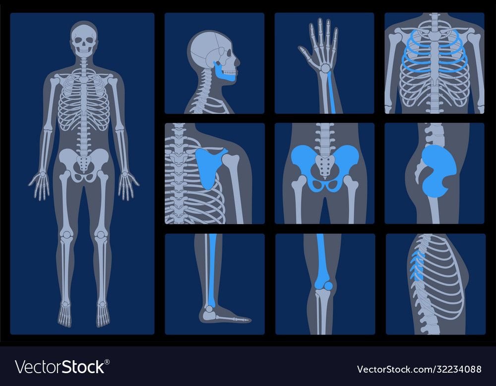 Skeleton x ray