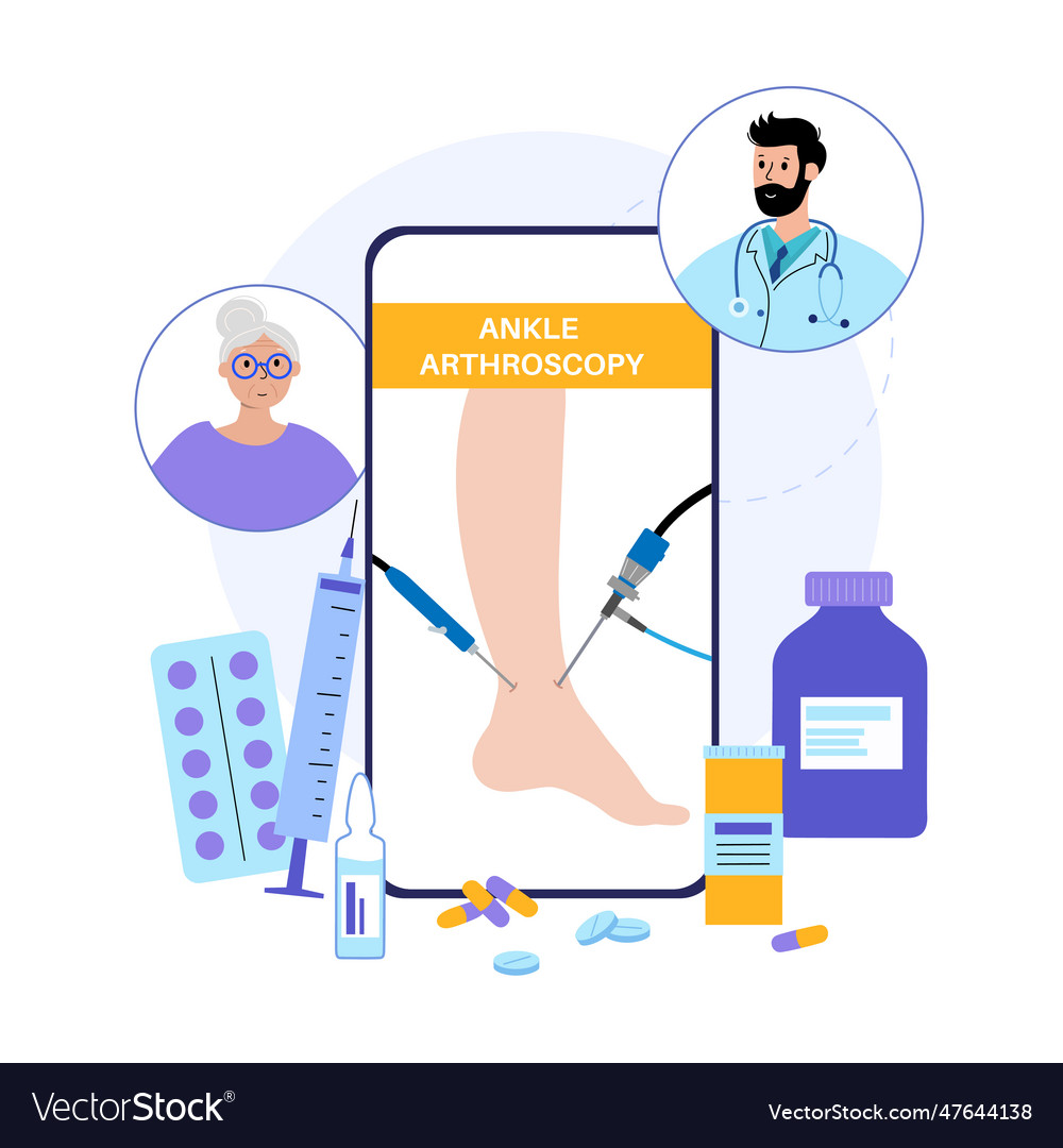 Ankle arthroscopy poster