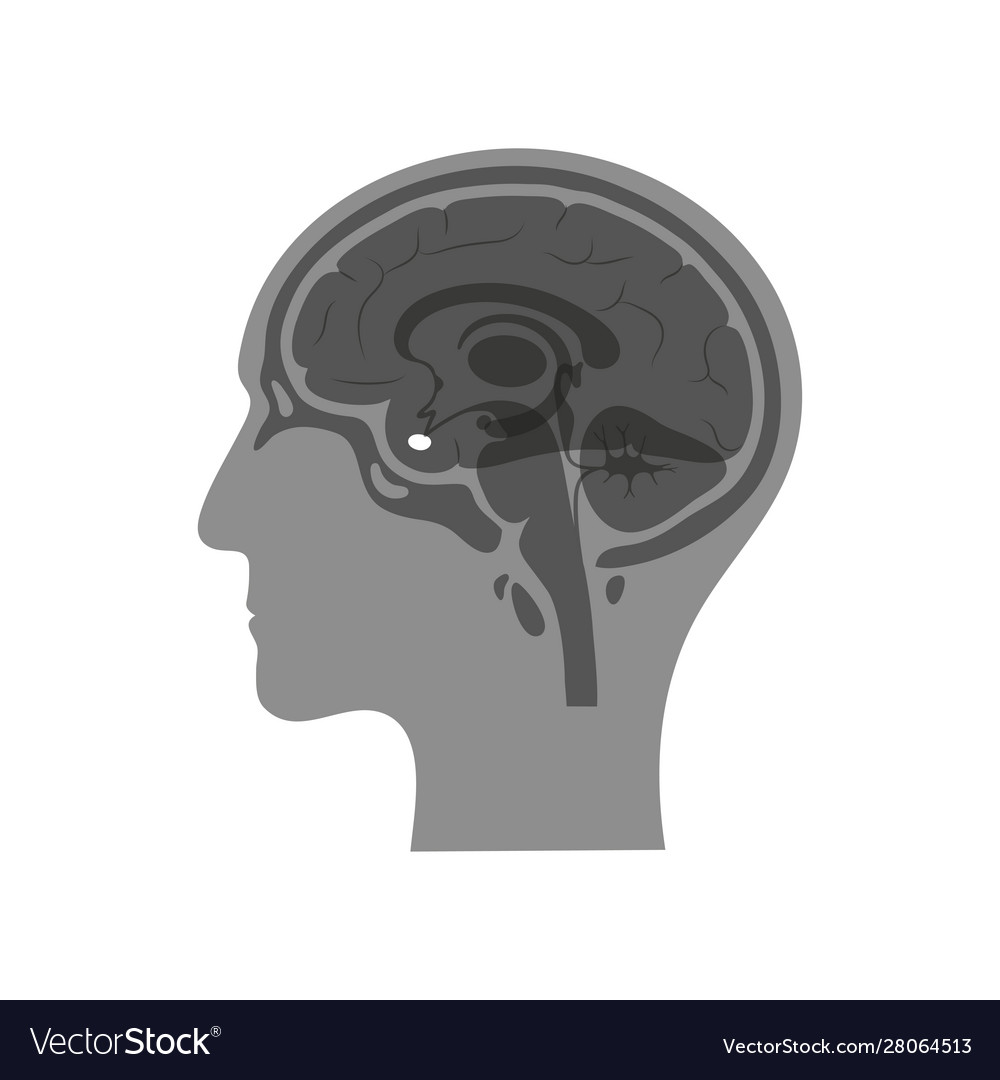 Isolated pituitary gland