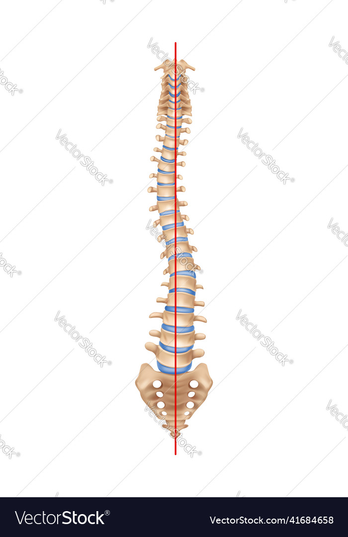 Realistic spine scoliosis composition