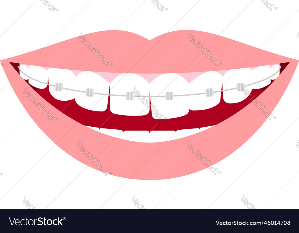 Esthetic dentistry and orthodontics distorted Vector Image