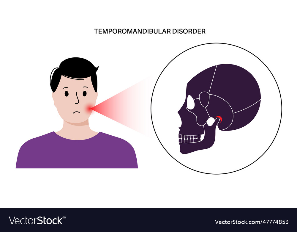 Tmd tmj disorder Royalty Free Vector Image - VectorStock