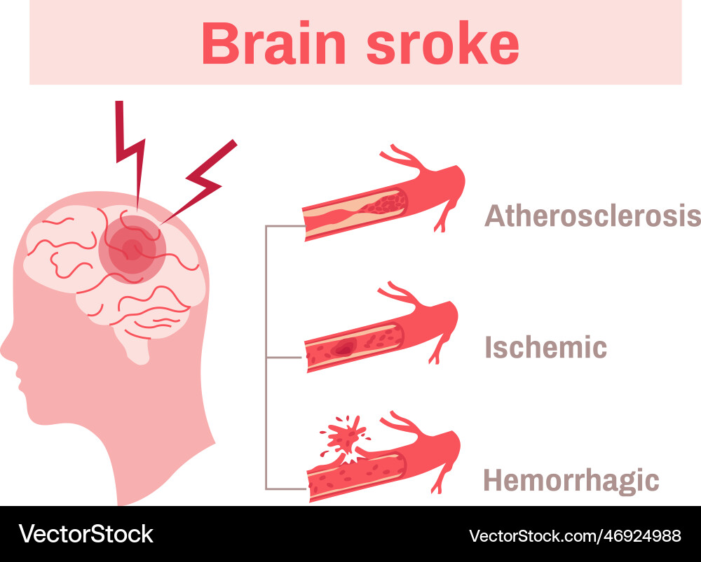 Stroke flat infographics Royalty Free Vector Image