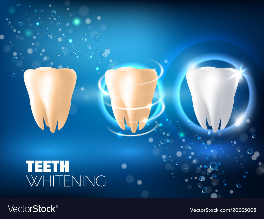 Teeth whitening ad realistic Royalty Free Vector Image