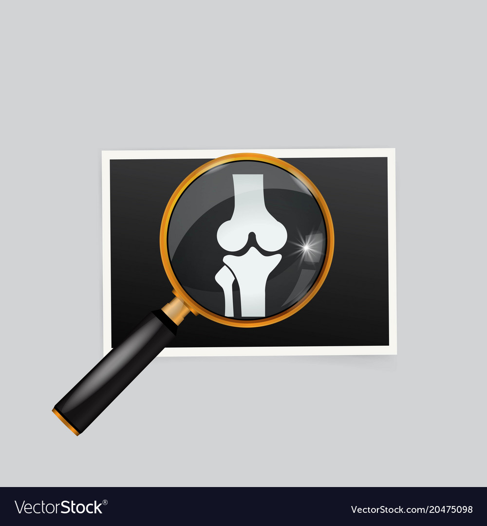 X-ray of the knee magnifying glass search