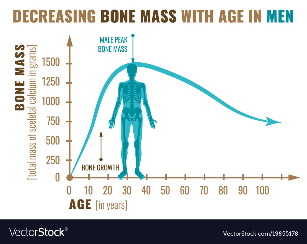 decreasing-bone-mass-royalty-free-vector-image