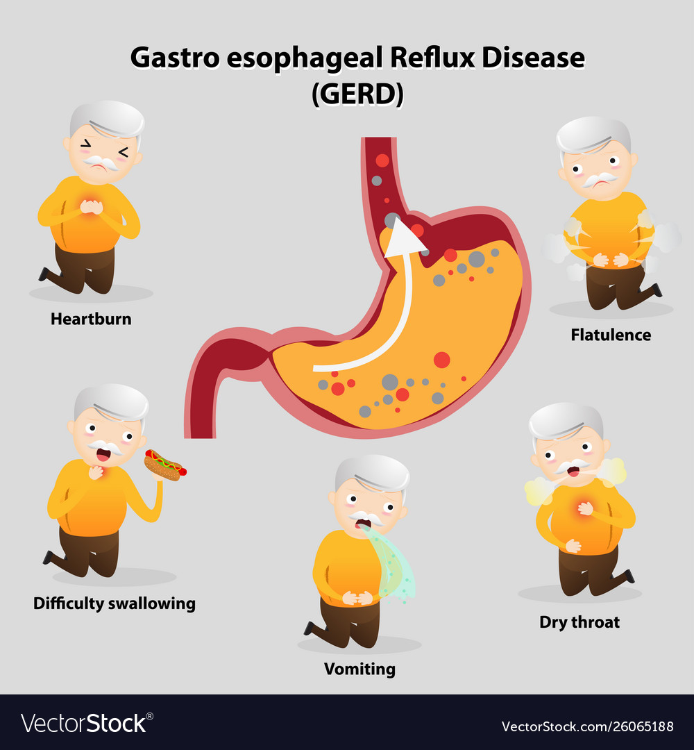 Gastro-esophageal reflux disease gerd Royalty Free Vector