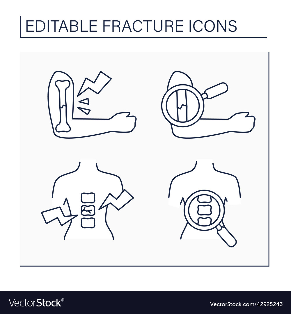 Fracture line icons set