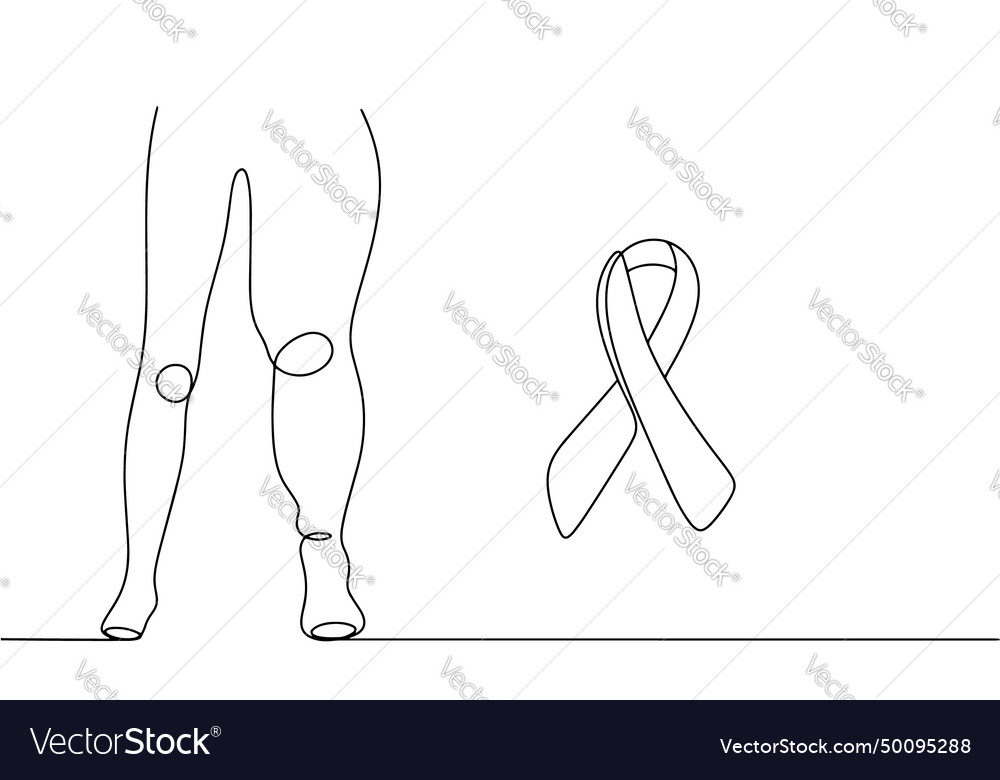 Lymphedema leg disease medicine ribbon Royalty Free Vector