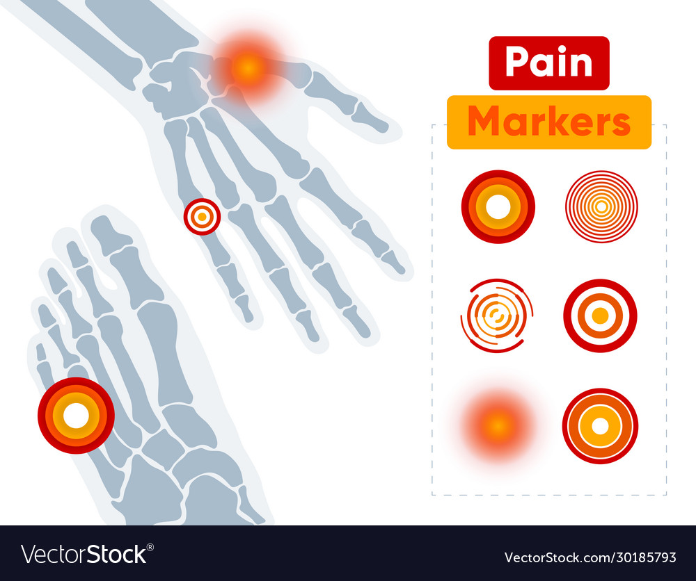 Set graphic pain markers