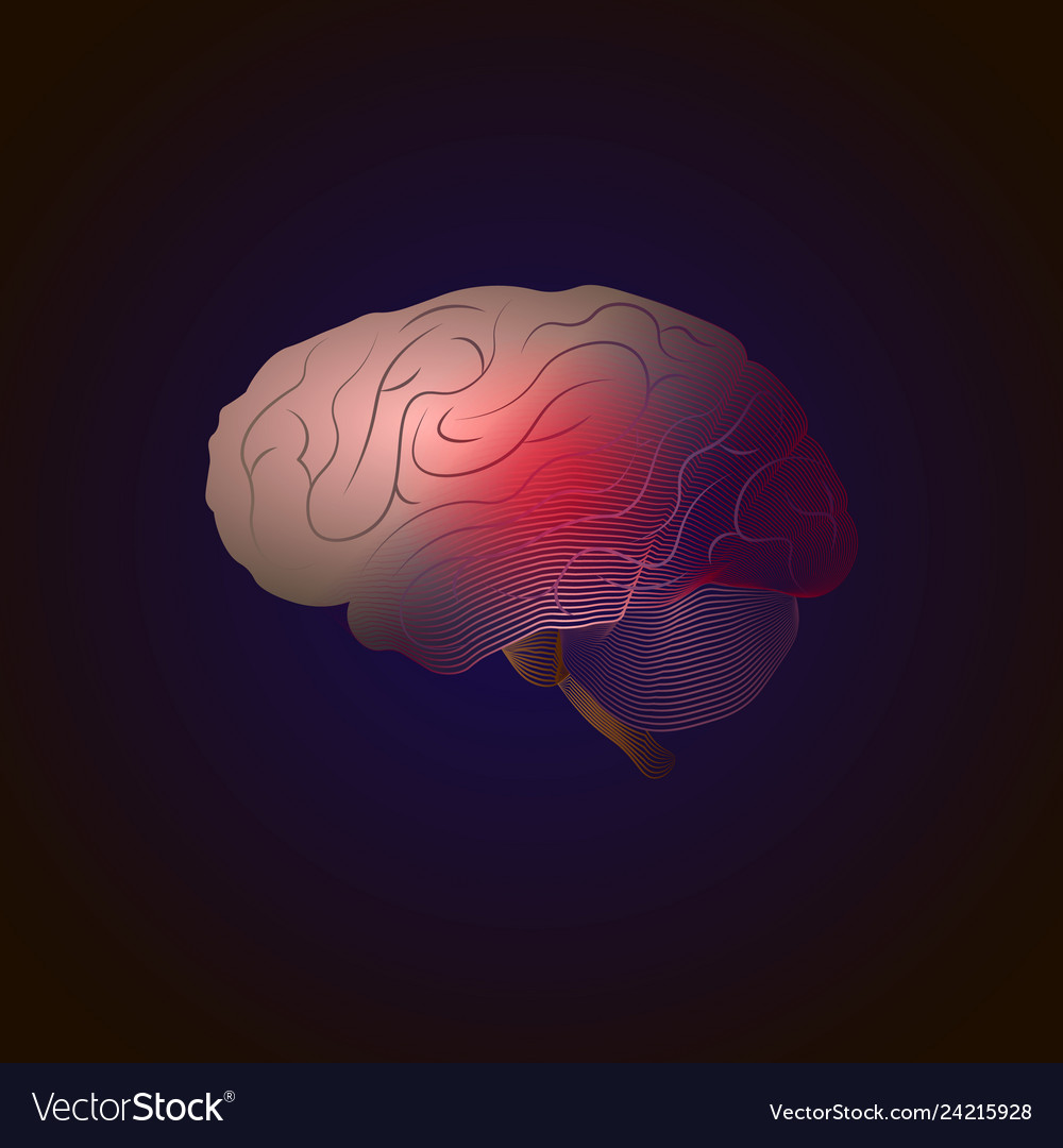 Transition from real to x-ray effect lines